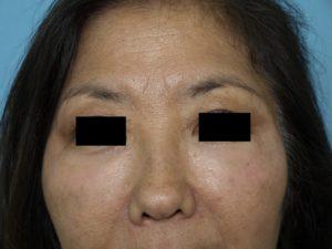 Bao Phan MD - Hawaii Plastic Surgery Institute provider photo