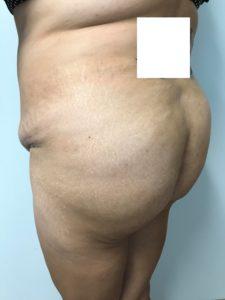 Bao Phan MD - Hawaii Plastic Surgery Institute provider photo