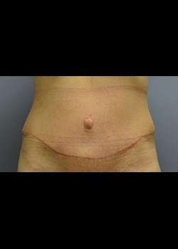 Jessica Belz, MD after — San Antonio, TX
