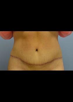Jessica Belz, MD after — San Antonio, TX
