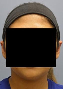 Jessica Belz, MD after — San Antonio, TX
