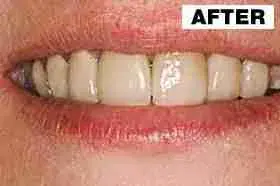 Point Loma Comprehensive Dental smile makeover after — San Diego, CA