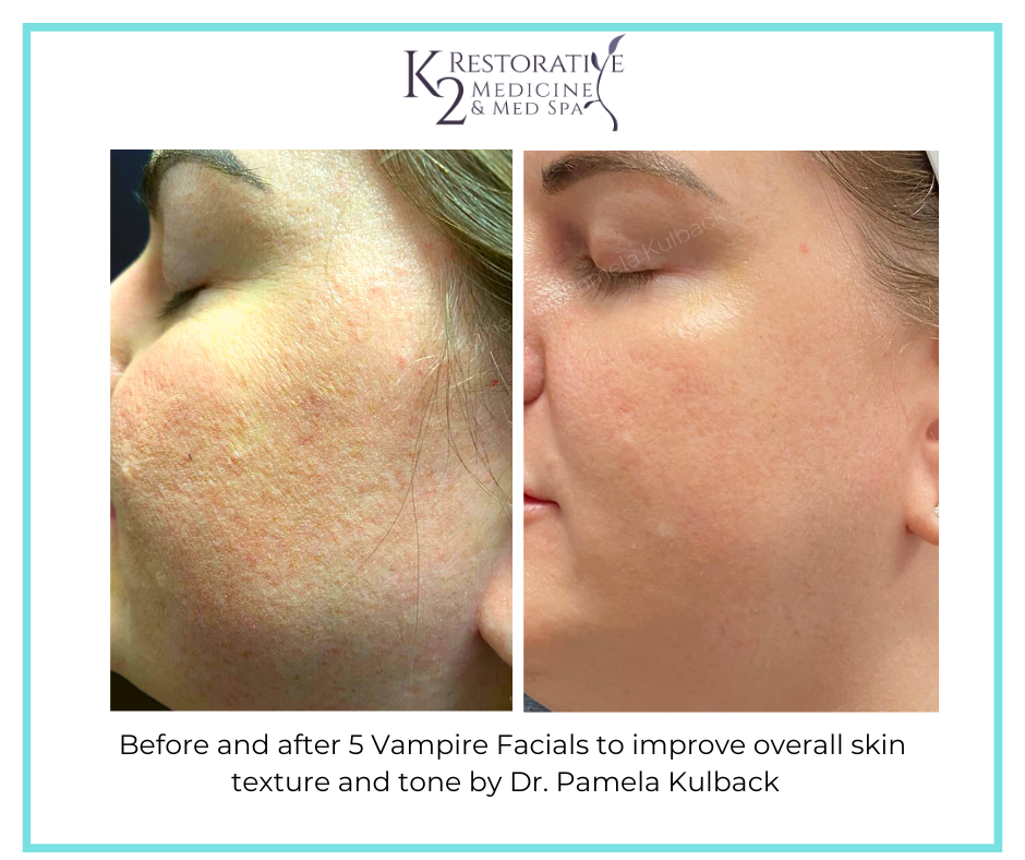 K2 Restorative Medicine & Med-Spa result — Birmingham, AL