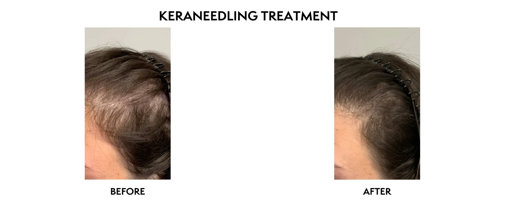 ICON Dermatology and Aesthetics result — North Bethesda, MD