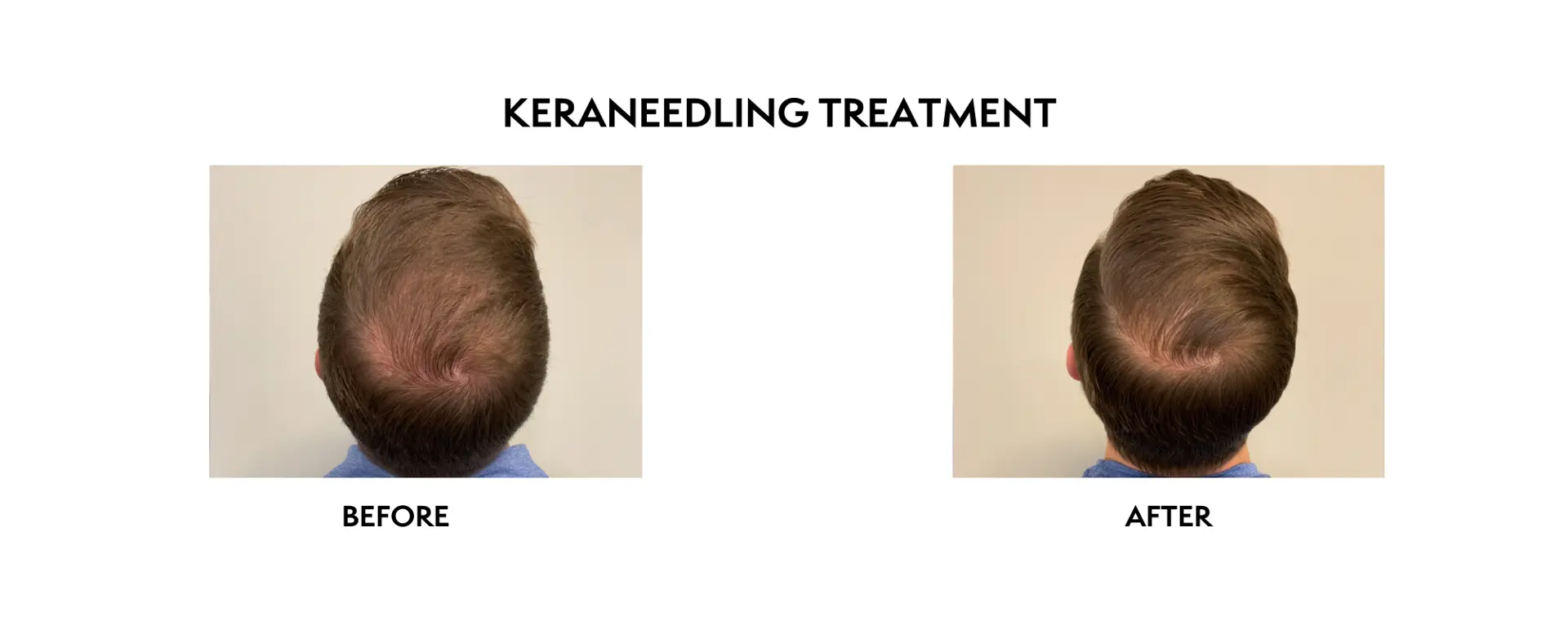 ICON Dermatology and Aesthetics result — North Bethesda, MD