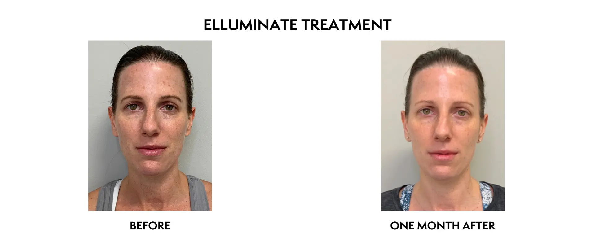 ICON Dermatology and Aesthetics result — North Bethesda, MD