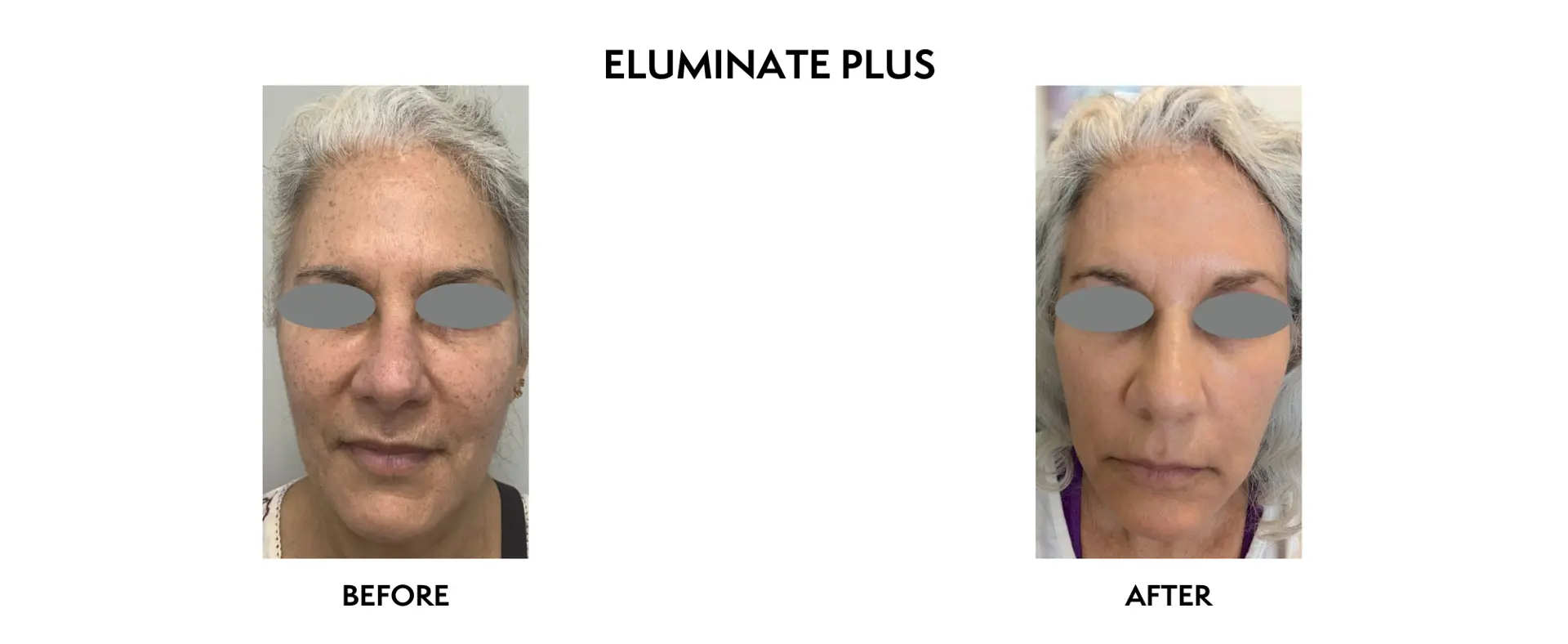 ICON Dermatology and Aesthetics result — North Bethesda, MD