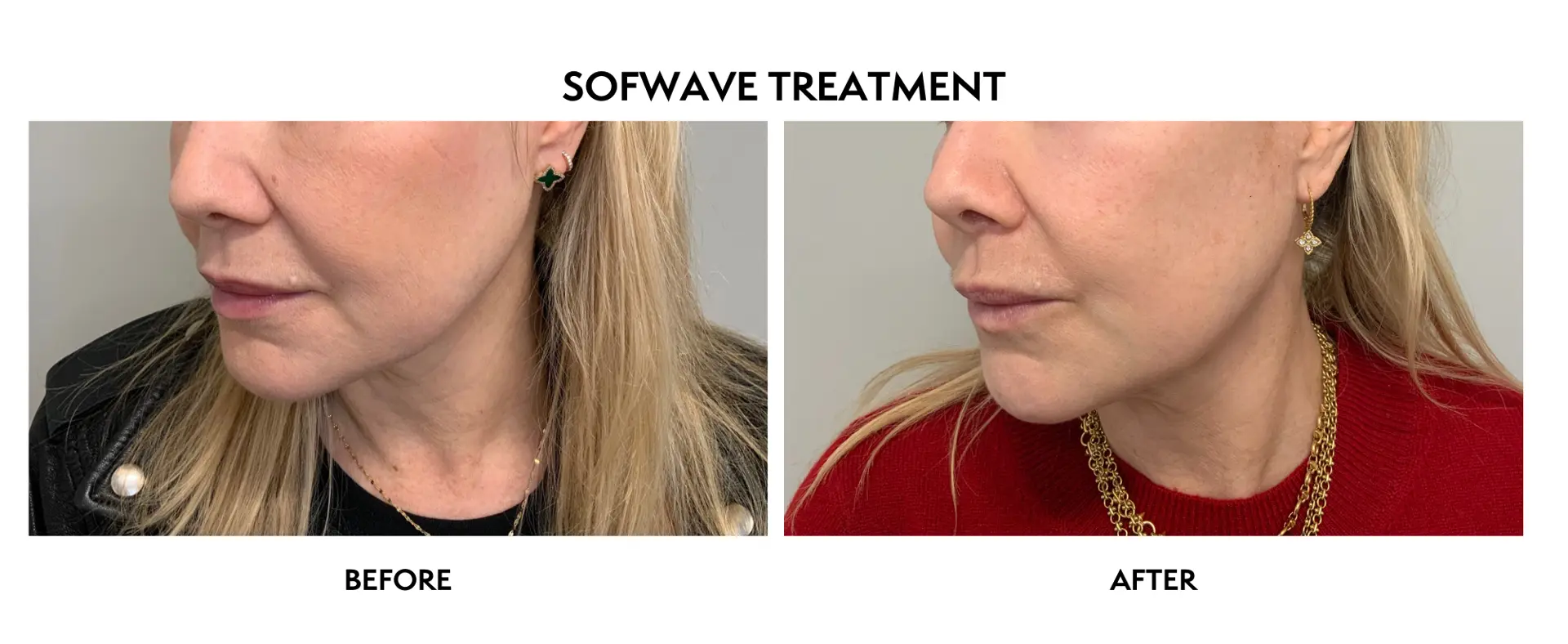 ICON Dermatology and Aesthetics result — North Bethesda, MD