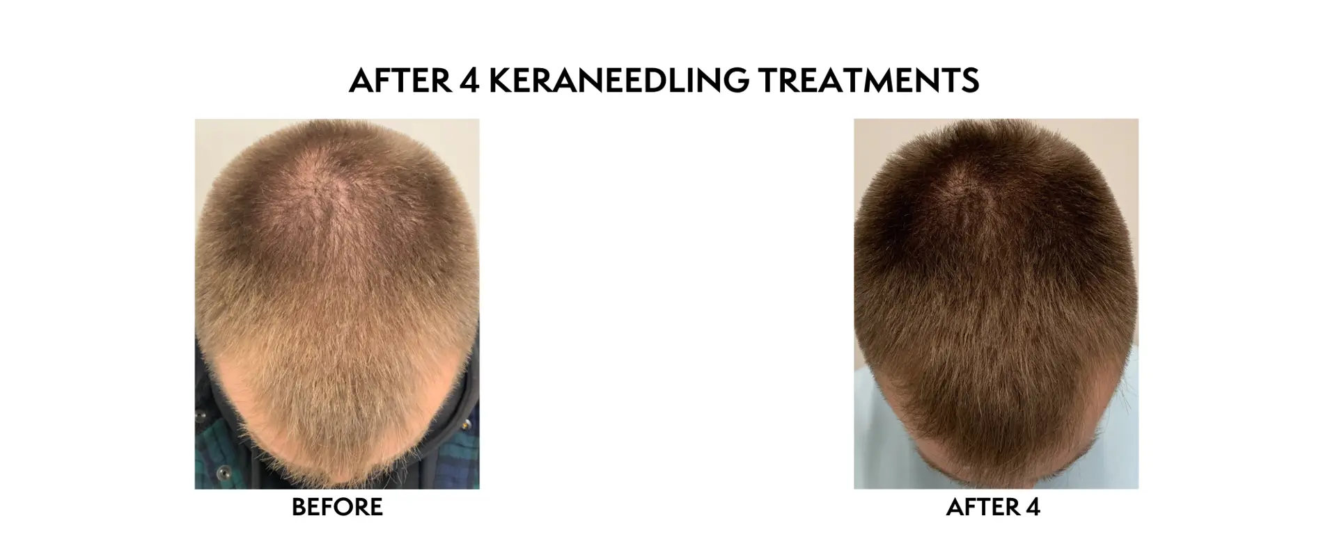 ICON Dermatology and Aesthetics result — North Bethesda, MD