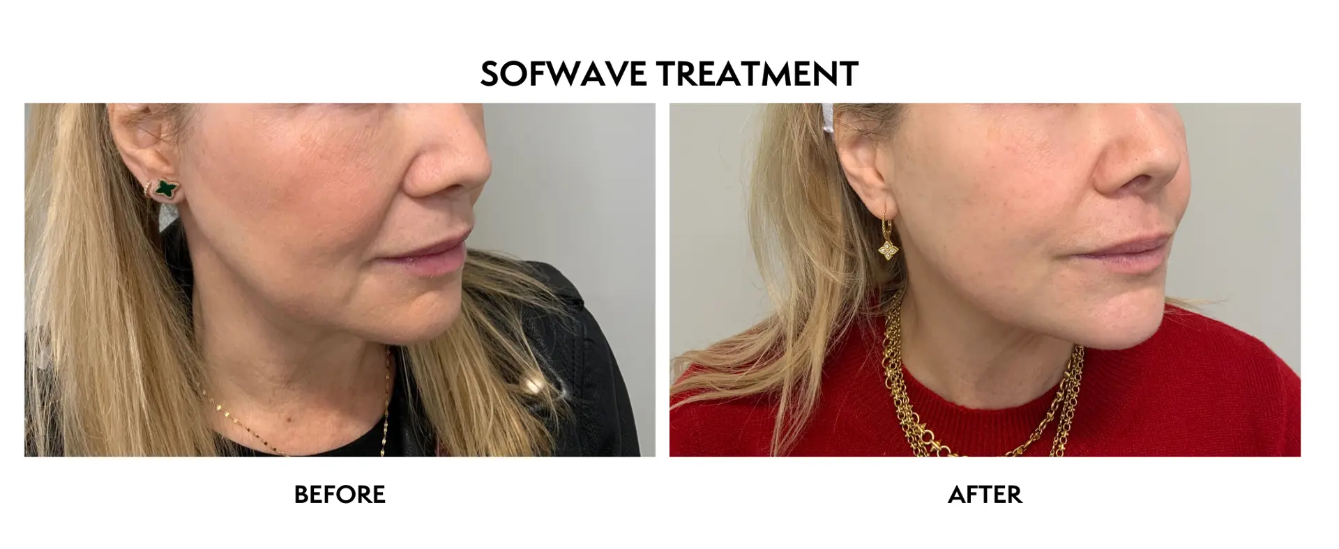 ICON Dermatology and Aesthetics result — North Bethesda, MD