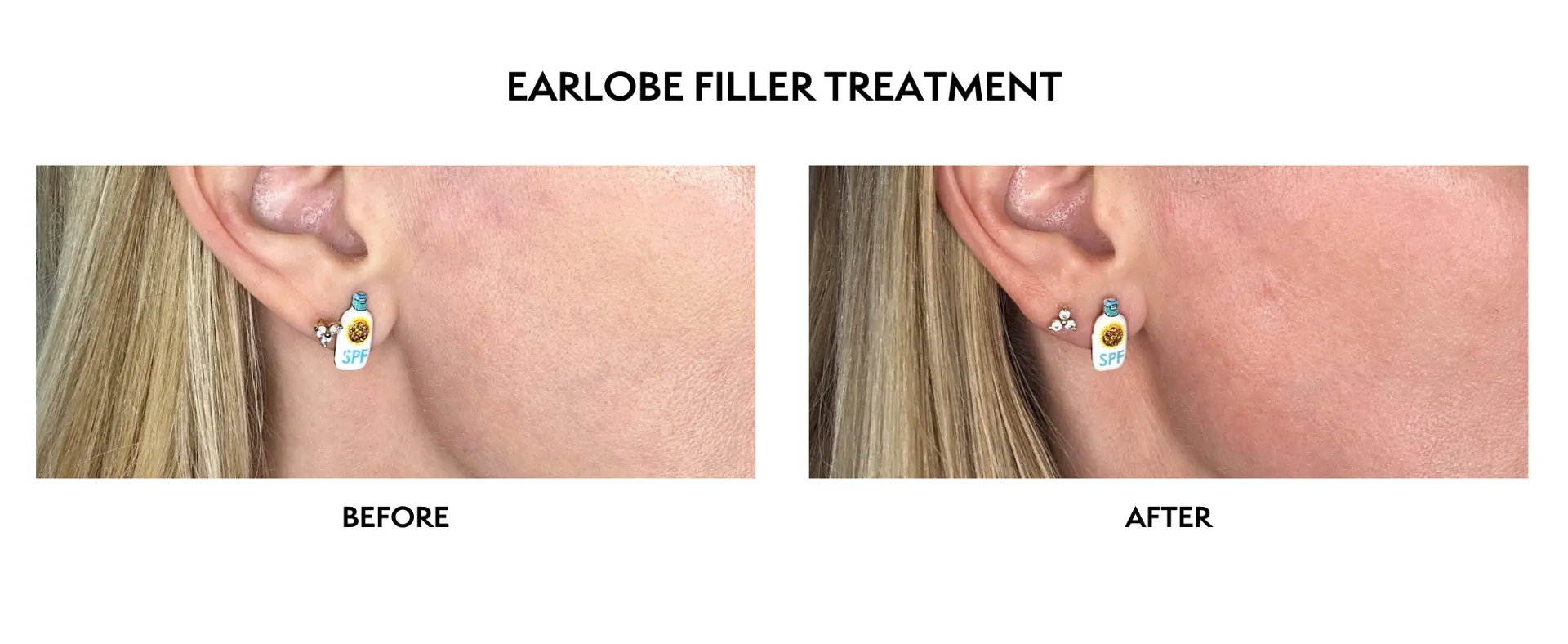 ICON Dermatology and Aesthetics result — North Bethesda, MD
