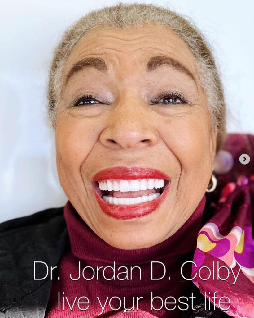 Oceanview Dental smile makeover after — Oceanside, CA