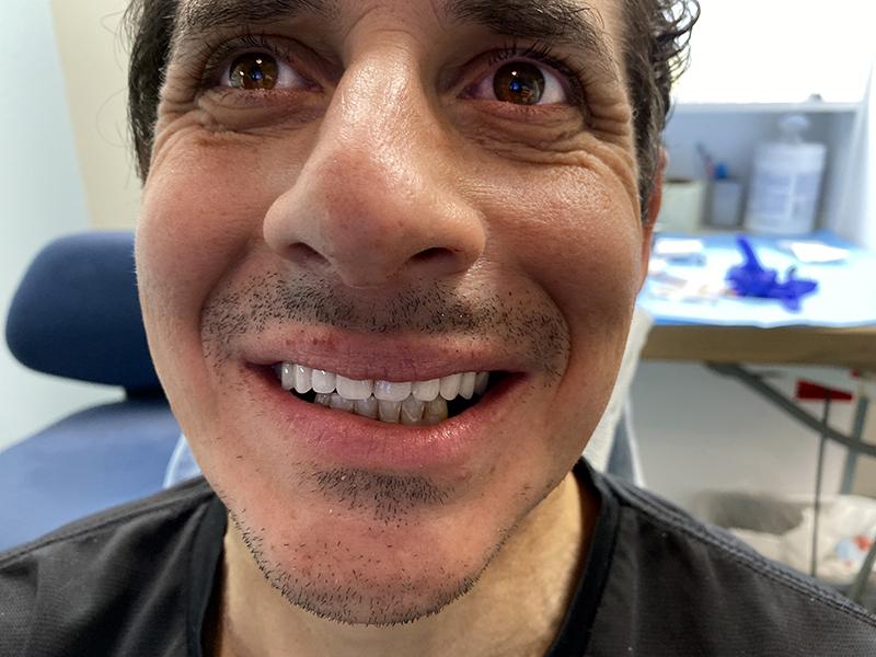 Oceanview Dental smile makeover after — Oceanside, CA