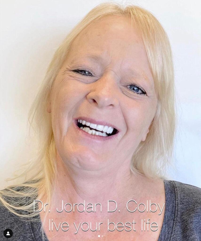 Oceanview Dental smile makeover after — Oceanside, CA