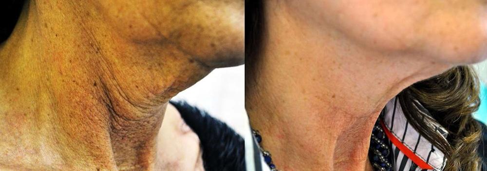 Perfect Med Spa result — New York, NY
