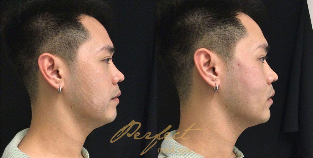 Perfect Med Spa result — New York, NY