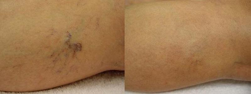 Perfect Med Spa result — New York, NY
