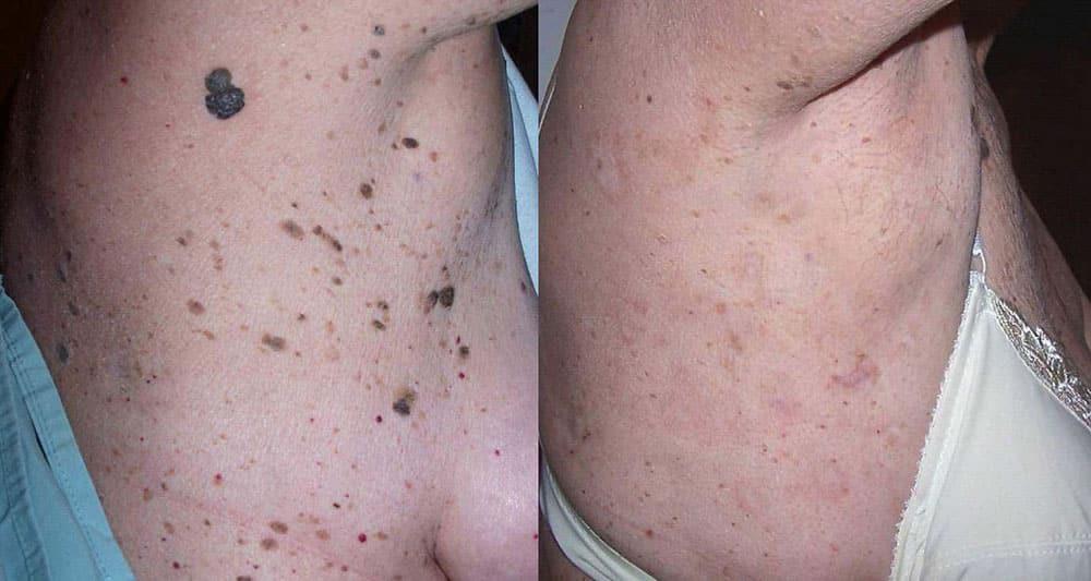 Perfect Med Spa result — New York, NY