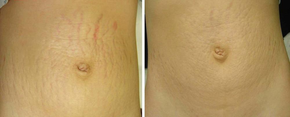 Perfect Med Spa result — New York, NY