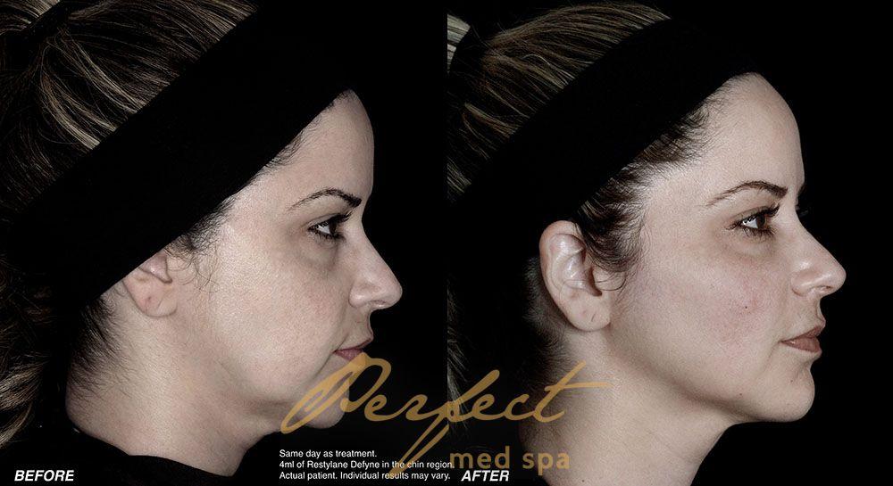 Perfect Med Spa result — New York, NY