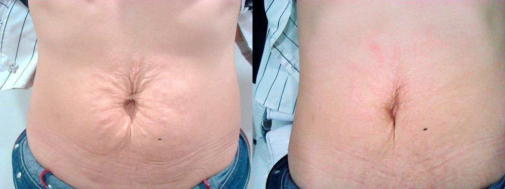 Perfect Med Spa result — New York, NY