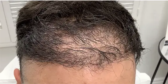 South Bay Med Spa result — Torrance, CA