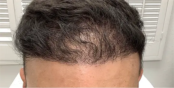 South Bay Med Spa after — Torrance, CA