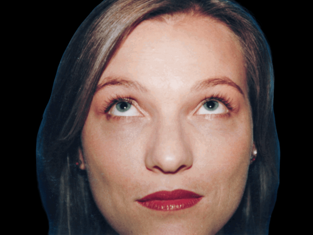 Blepharoplasty after at Aesthetic Surgery Center: Michael R. Macdonald, M.D. in San Francisco, CA