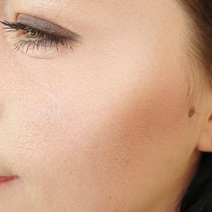 Spa Trouvé under-eye filler after — Pleasant Grove, UT