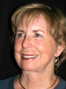Altos Oaks Plastic Surgery facelift after — Los Altos, CA