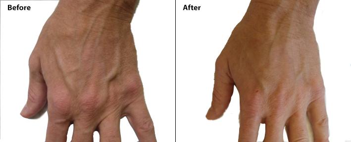 Dr. Tal Dagan, MD, FACS result — New York, NY