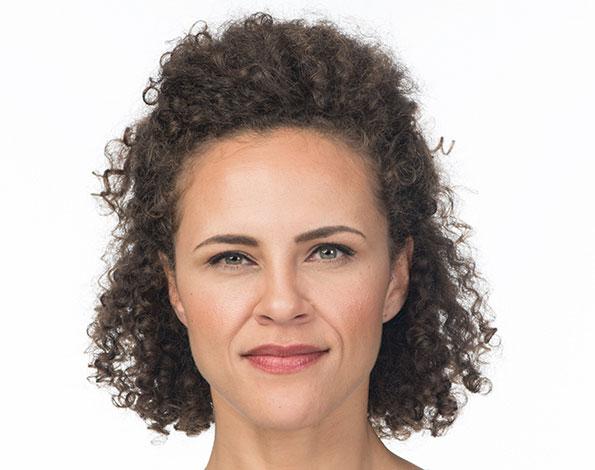 Dr. Tal Dagan, MD, FACS botox after — New York, NY