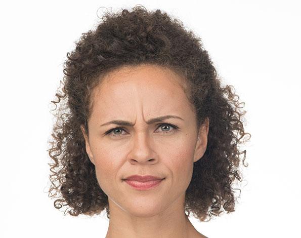 Botox before at Dr. Tal Dagan, MD, FACS in New York, NY
