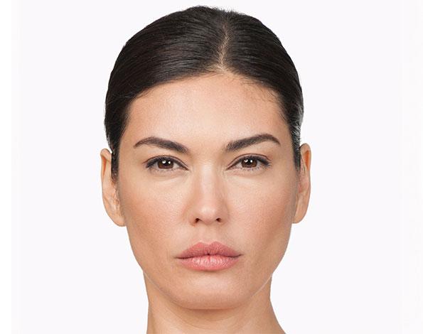 Dr. Tal Dagan, MD, FACS botox after — New York, NY