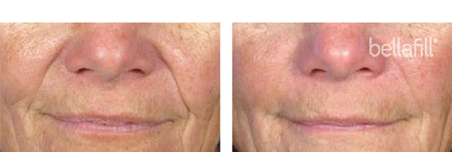Dr. Tal Dagan, MD, FACS result — New York, NY