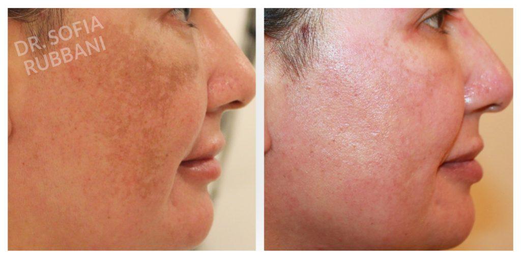 Tucson Cosmetics result — Tucson, AZ