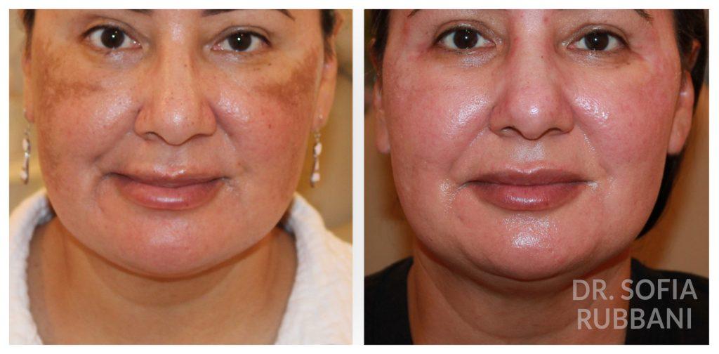 Tucson Cosmetics result — Tucson, AZ