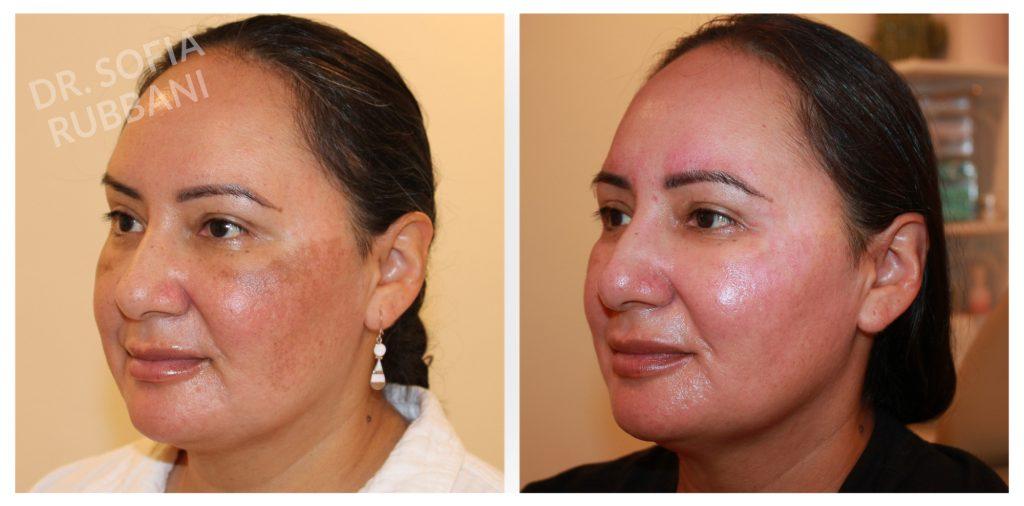 Tucson Cosmetics result — Tucson, AZ