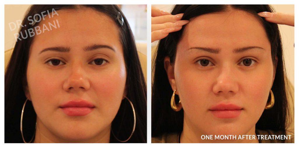 Tucson Cosmetics result — Tucson, AZ
