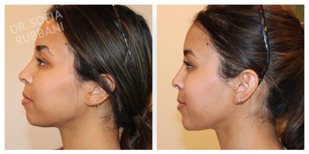 Tucson Cosmetics result — Tucson, AZ