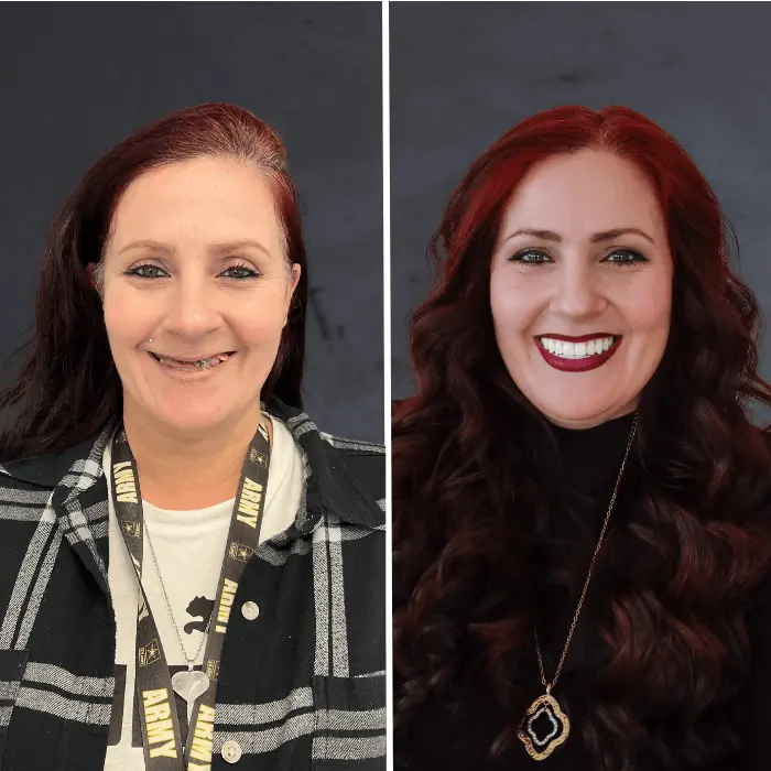 Stubbs Dental Implant Center veneers result — Salt Lake City, UT