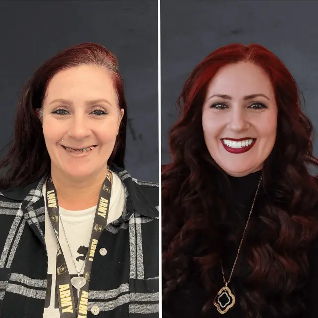 Dental Veneers result at Stubbs Dental Implant Center in Salt Lake City, UT
