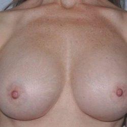 Breast Augmentation after at My Houston Surgeons in Houston, TX