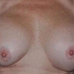 Breast Augmentation before at My Houston Surgeons in Houston, TX