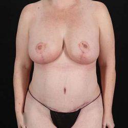 My Houston Surgeons provider photo