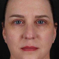My Houston Surgeons after — Houston, TX