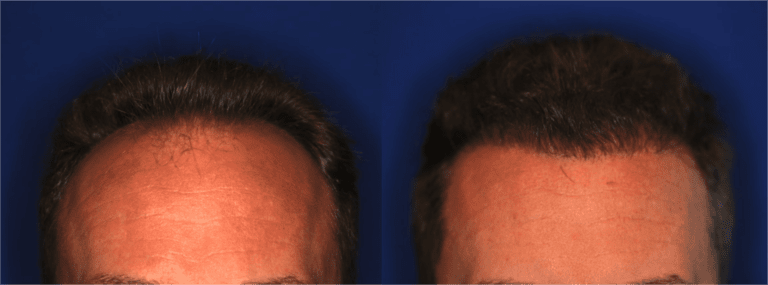 The Irvine Institute of Medicine & Cosmetic Surgery after — Irvine, CA