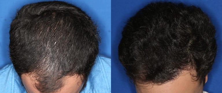 The Irvine Institute of Medicine & Cosmetic Surgery after — Irvine, CA