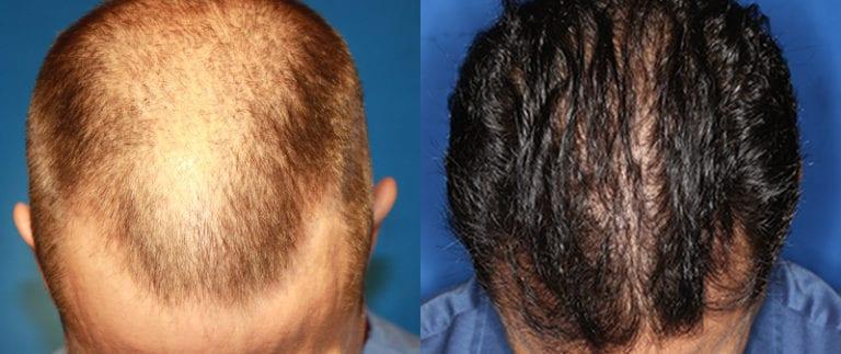 The Irvine Institute of Medicine & Cosmetic Surgery after — Irvine, CA
