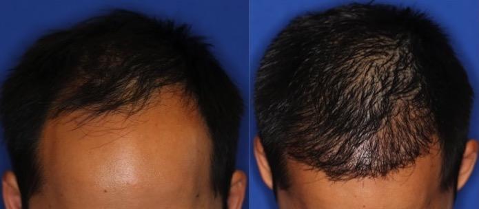 The Irvine Institute of Medicine & Cosmetic Surgery after — Irvine, CA